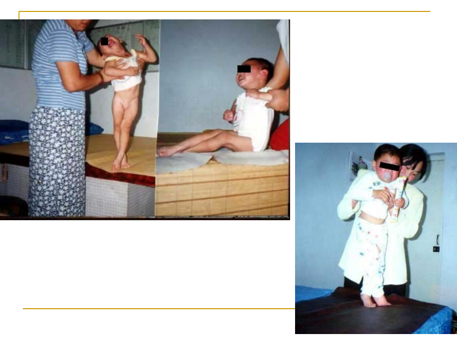 肌张力及评定-.ppt_第2页