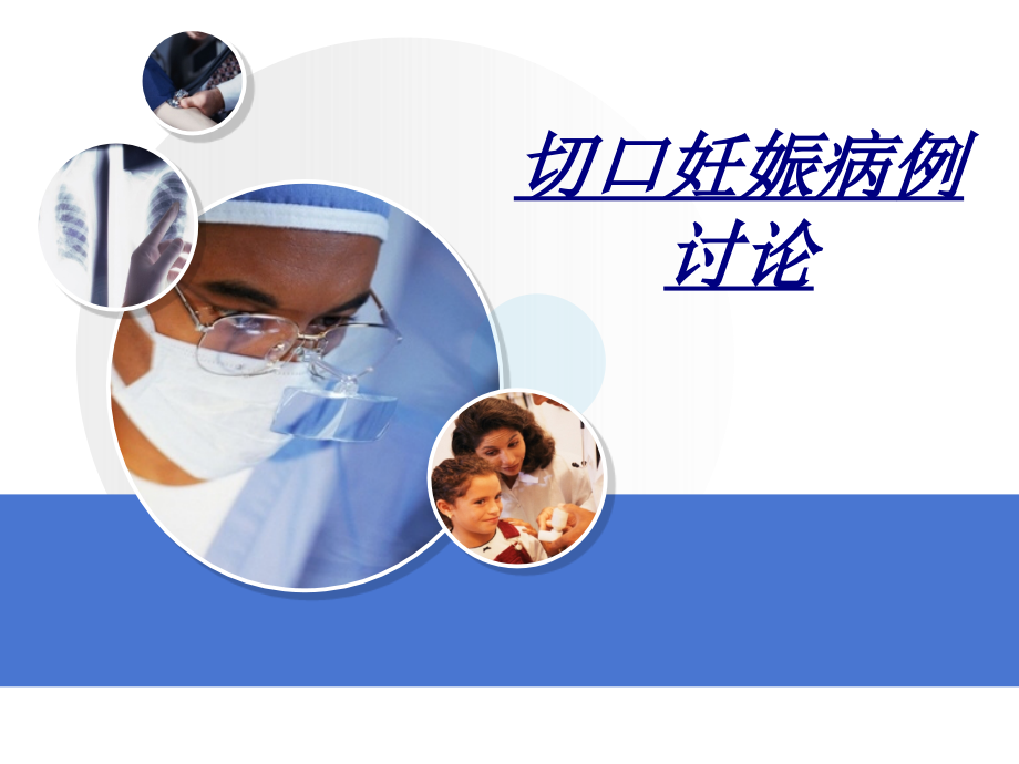 切口妊娠病例讨论讲义.ppt_第1页