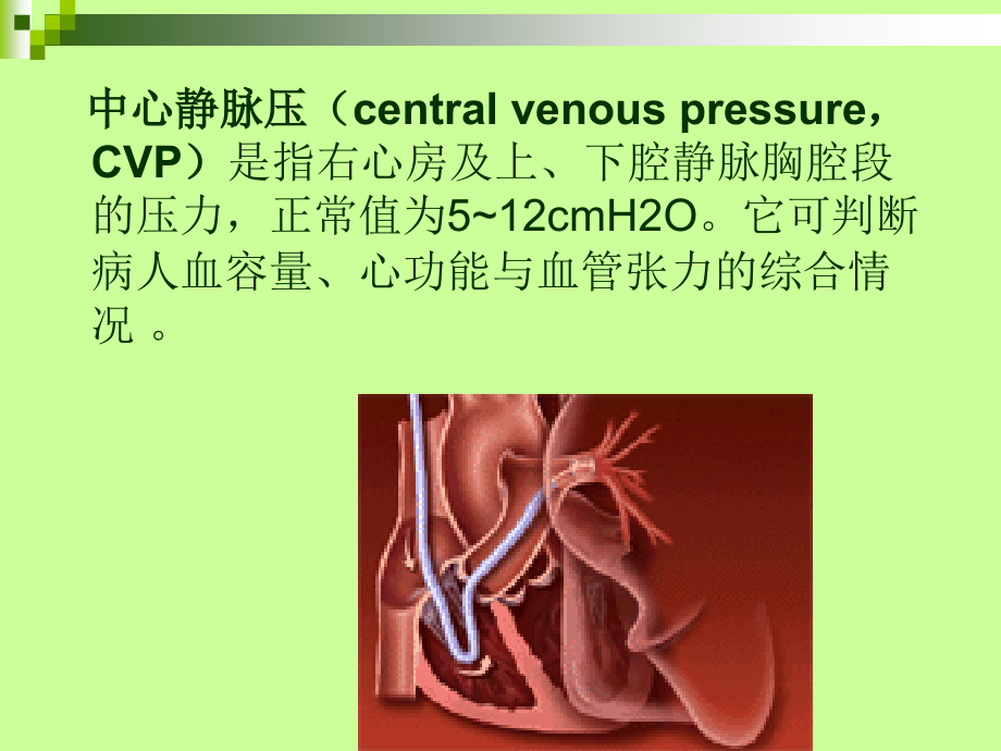 CVP监测的意义和护理ppt.ppt_第2页