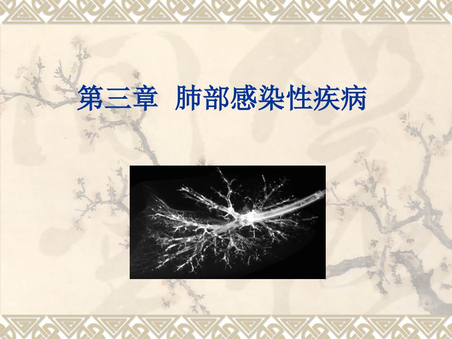 肺炎-教学课件.ppt_第1页