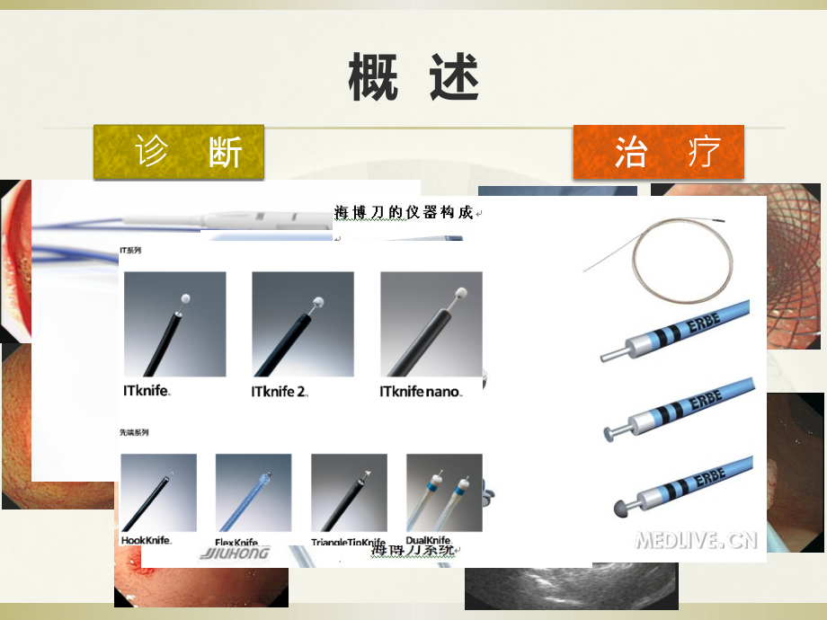 医学消化道早癌的诊断课件.pptx_第2页
