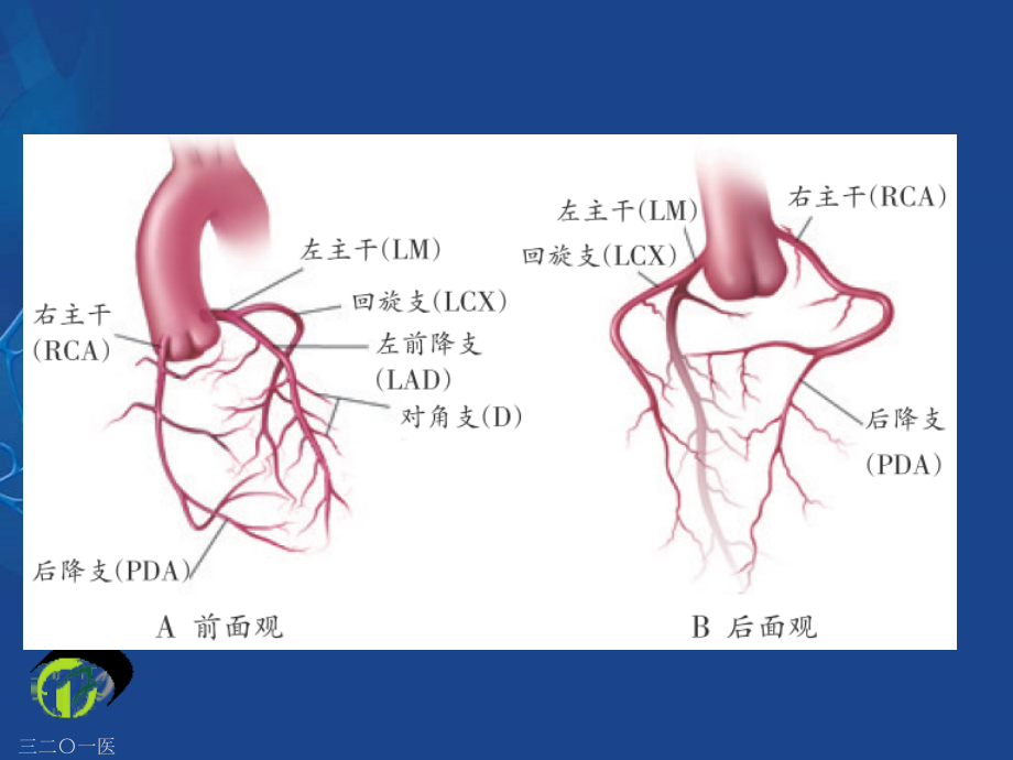 医学课件冠状动脉的解剖与冠脉造影.ppt_第2页