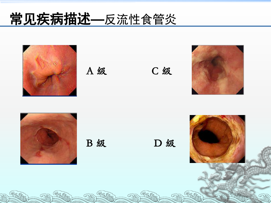 内镜报告书写规范主题讲座课件.ppt_第2页