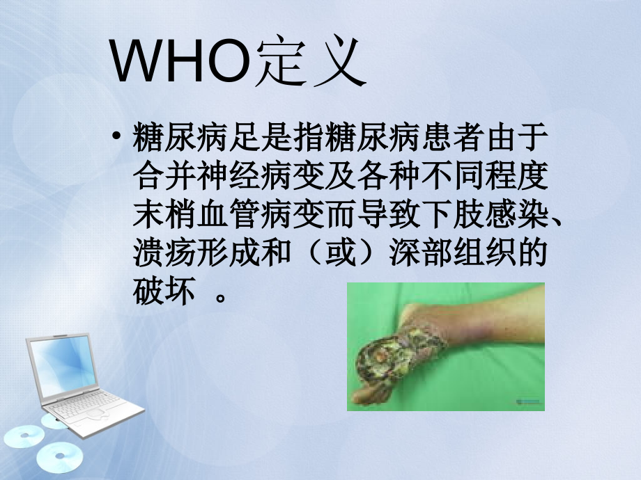 糖尿病足截肢术后护理.ppt_第2页