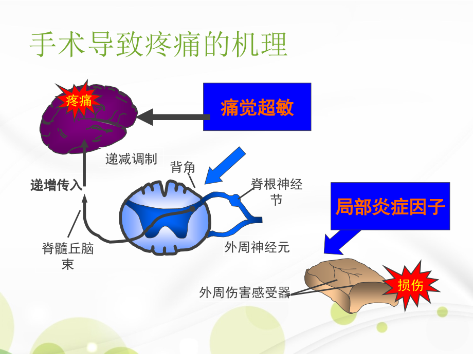 医学课件围手术期患者疼痛管理.ppt_第2页