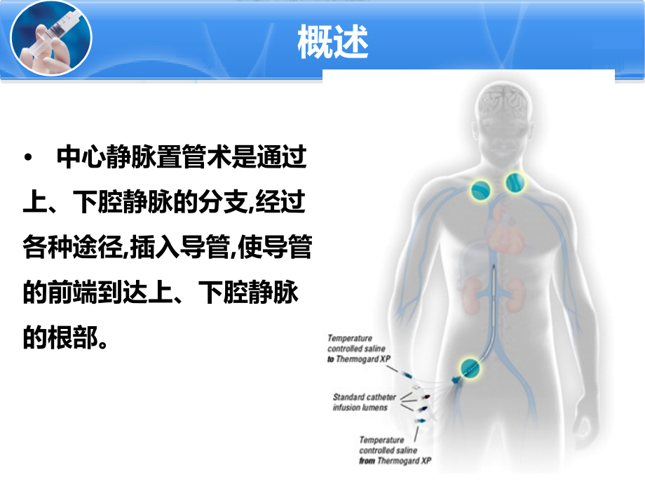 中心静脉置管.pptx_第2页
