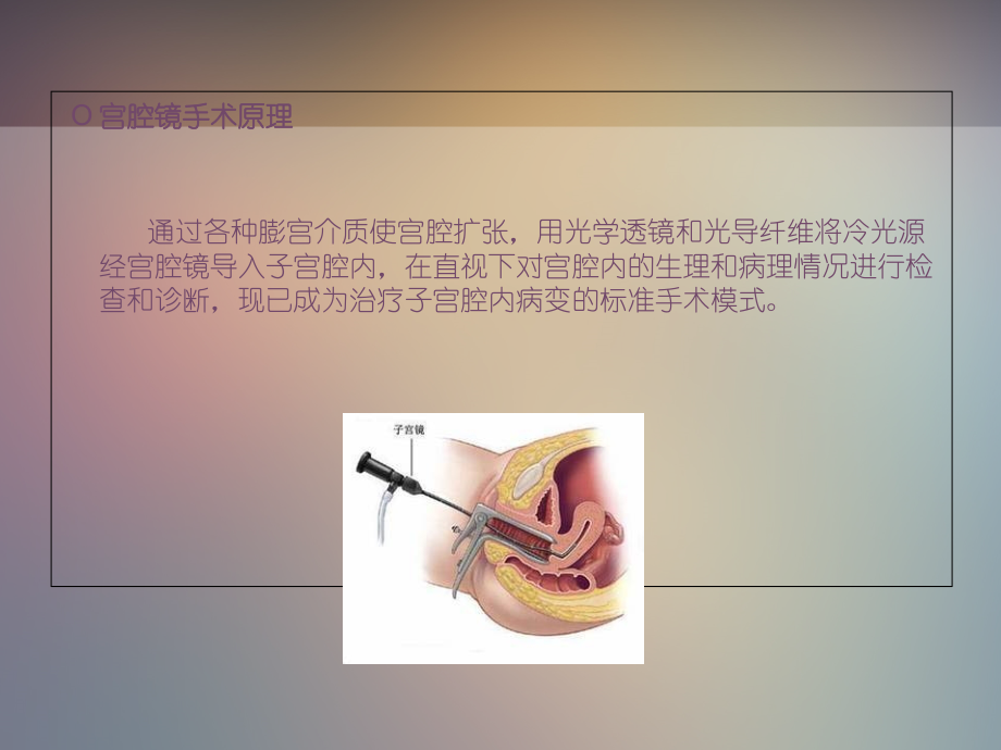 医学宫腔镜手术病人的手术配合和医疗医疗护理PPT.ppt_第2页