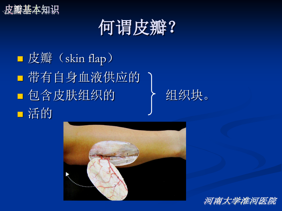 医学皮瓣的基本知识ppt.ppt_第2页