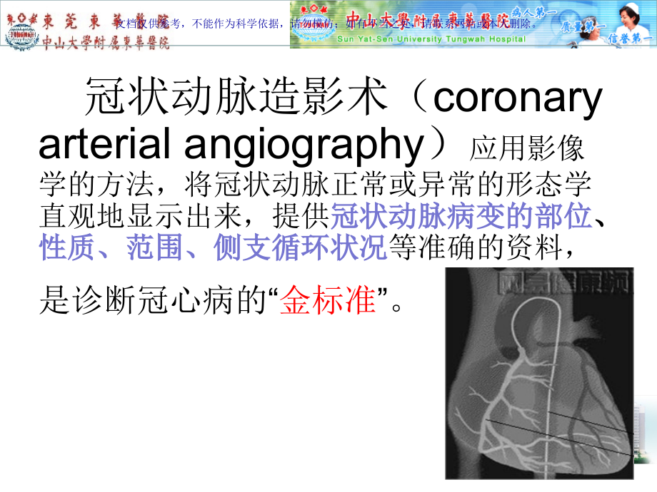 冠脉造影术前术后的医疗护理课件.ppt_第2页
