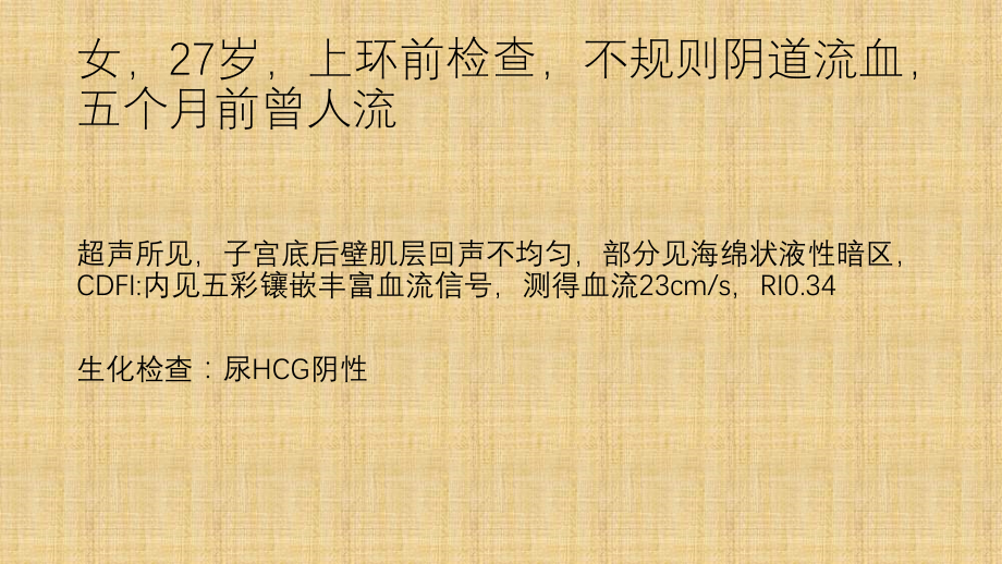 子宫动静脉瘘优质课件.pptx_第2页