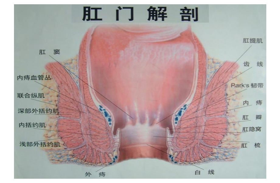 医学课件痔疮术进展和术前后医疗护理.ppt_第2页