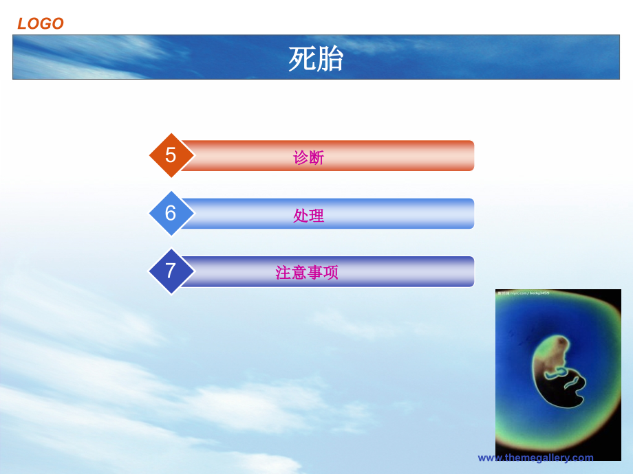 死胎专题宣讲.ppt_第2页