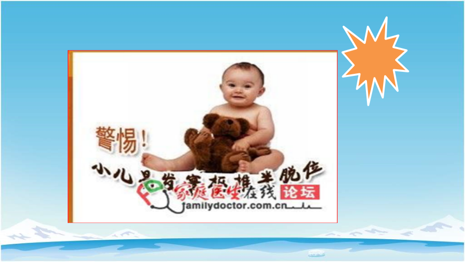 儿童寰枢椎脱位专题培训课件.ppt_第2页