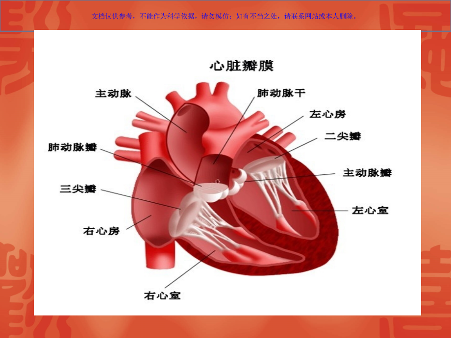心脏瓣膜病术后护理课件.ppt_第2页
