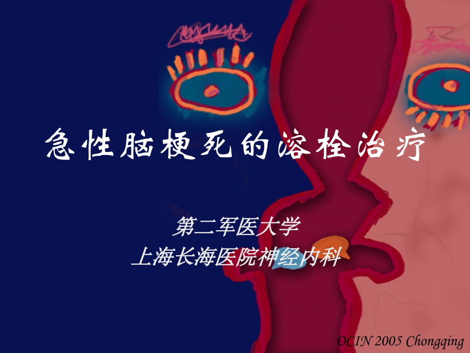 急性脑梗死的溶栓治疗-.ppt_第1页