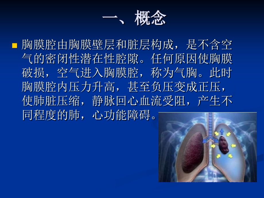 气胸患者的护理.ppt_第2页
