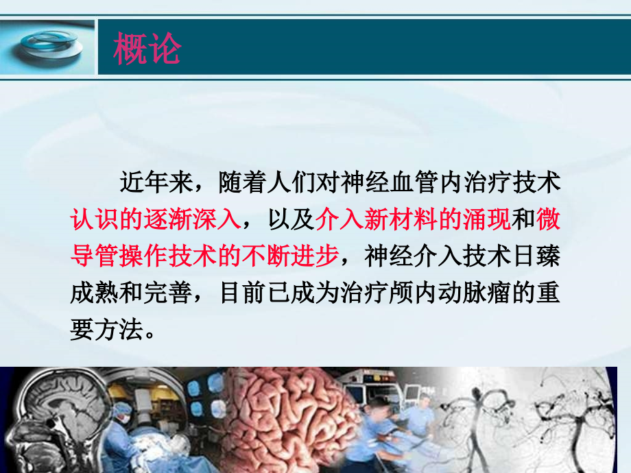 颅内动脉瘤血管内治疗进展吴中学.ppt_第2页