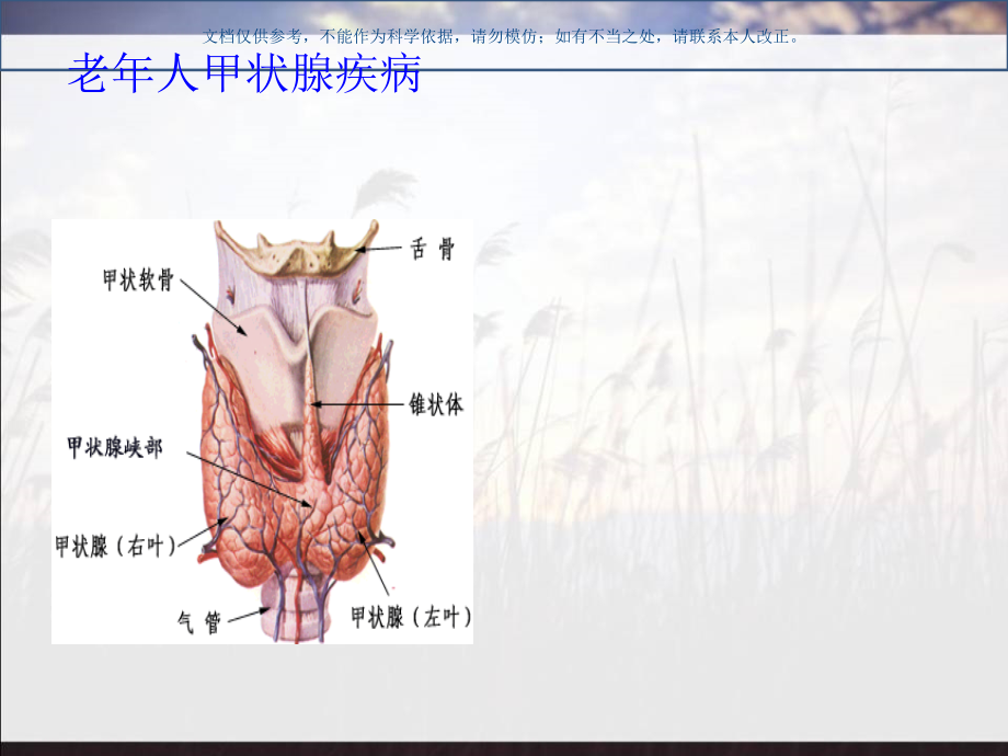 老年人甲状腺疾病课件.ppt_第1页