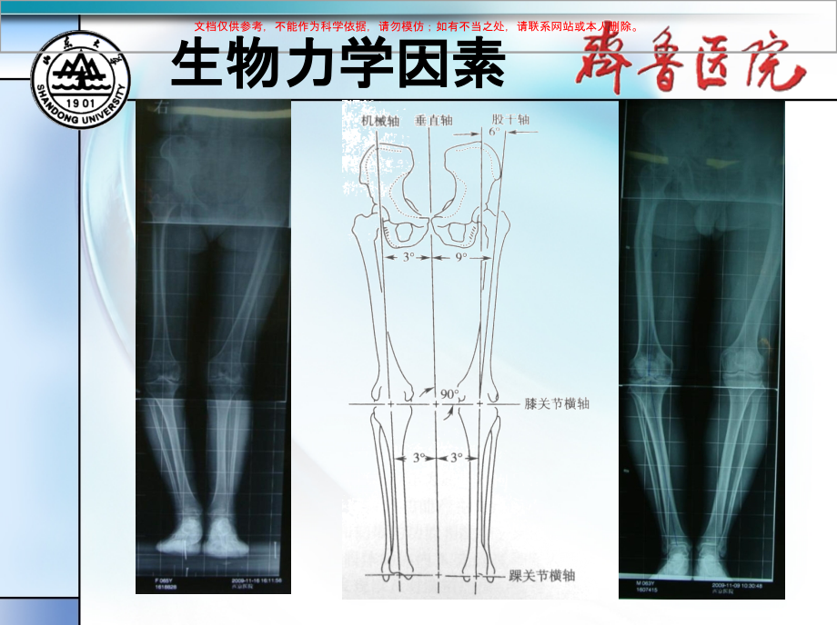 下肢力线研究课件.ppt_第1页