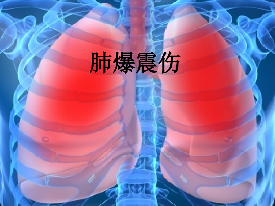 肺爆震伤-.ppt_第1页