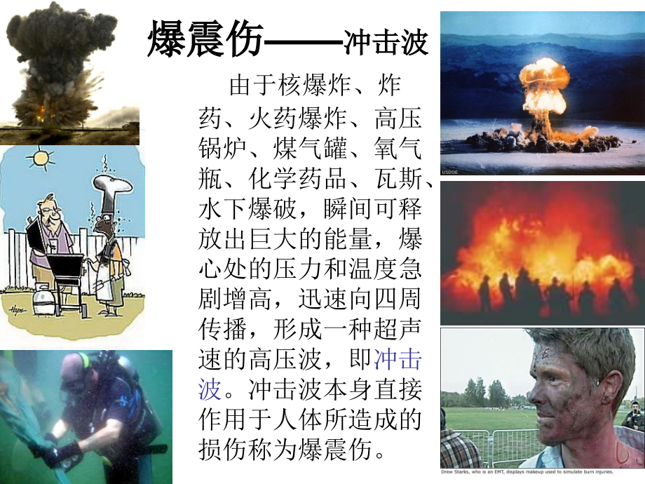 肺爆震伤-.ppt_第2页