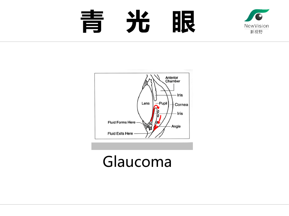 医学课件青光眼基础知识.ppt_第1页