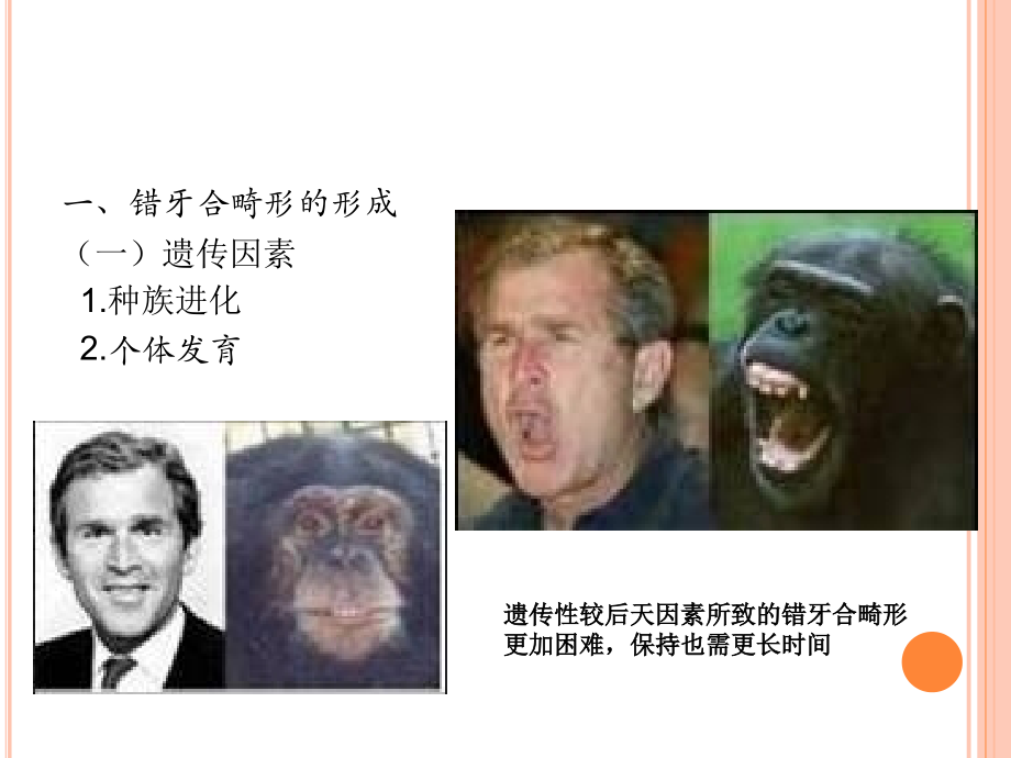 口腔正畸.ppt_第2页