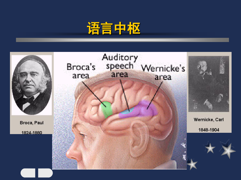 医学课件失语症的康复治疗.ppt_第2页
