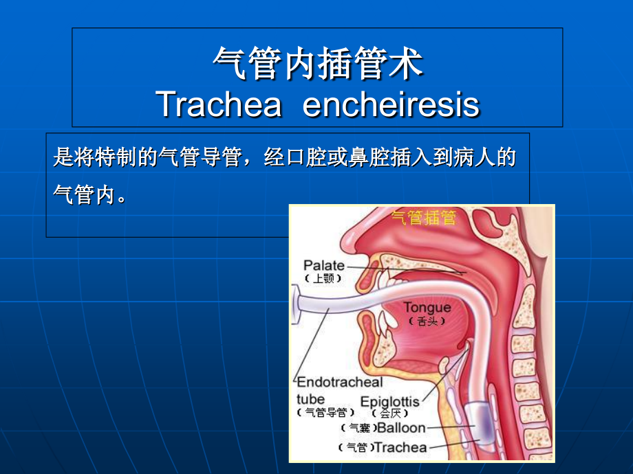 气管插管术[1]课件.ppt_第2页