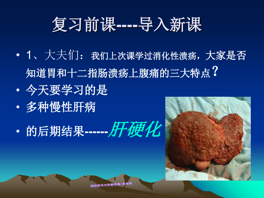 肝硬化完整.ppt_第2页