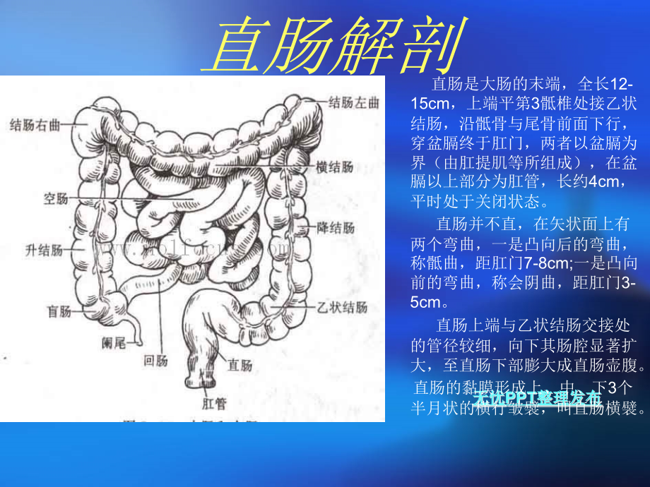 医学课件直肠癌手术配合.ppt_第2页