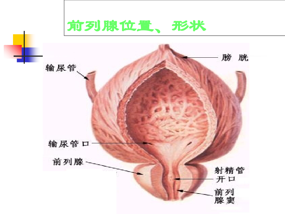 前列腺疾病综述PPT.ppt_第2页