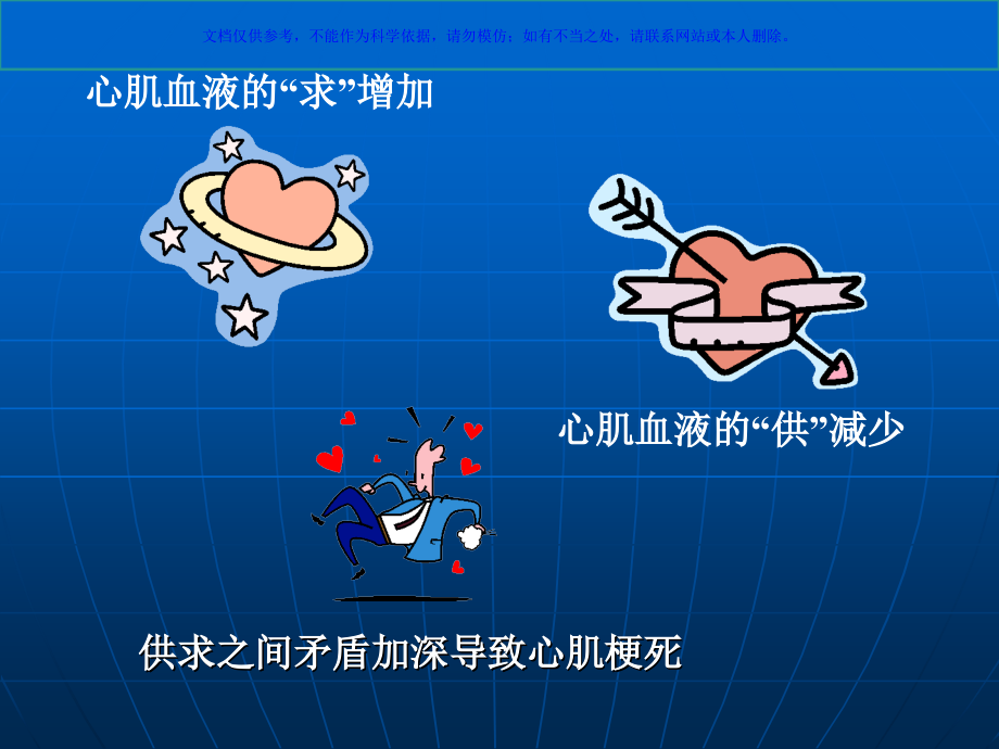 心肌梗死的饮食和运动指导课件.ppt_第2页