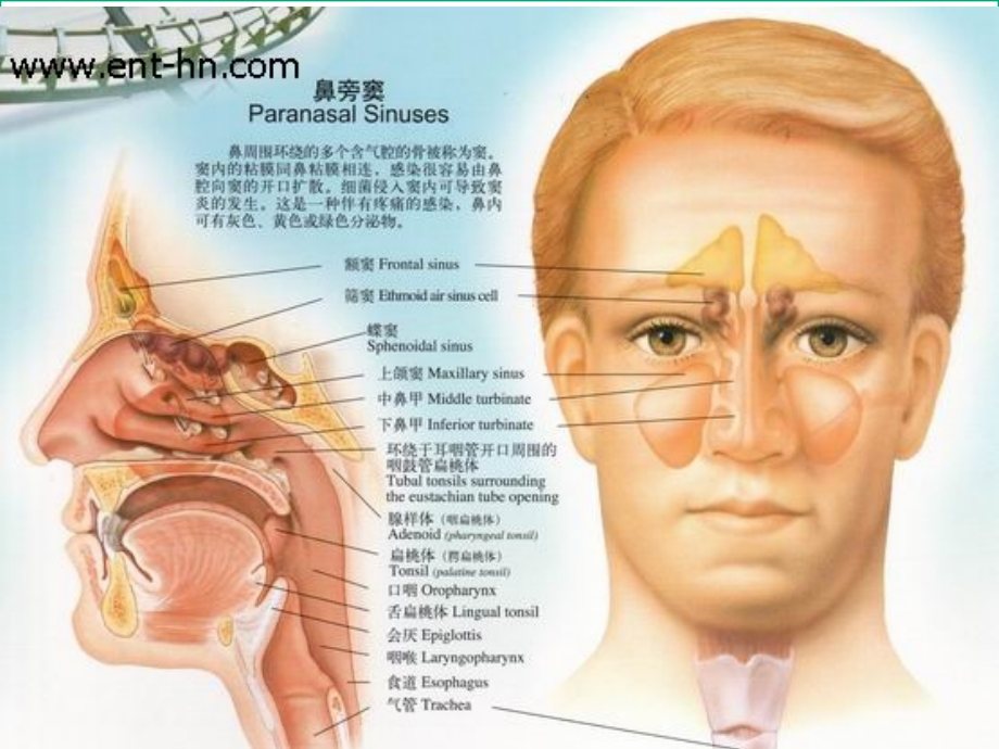 鼻窦炎专题知识讲座课件.ppt_第1页