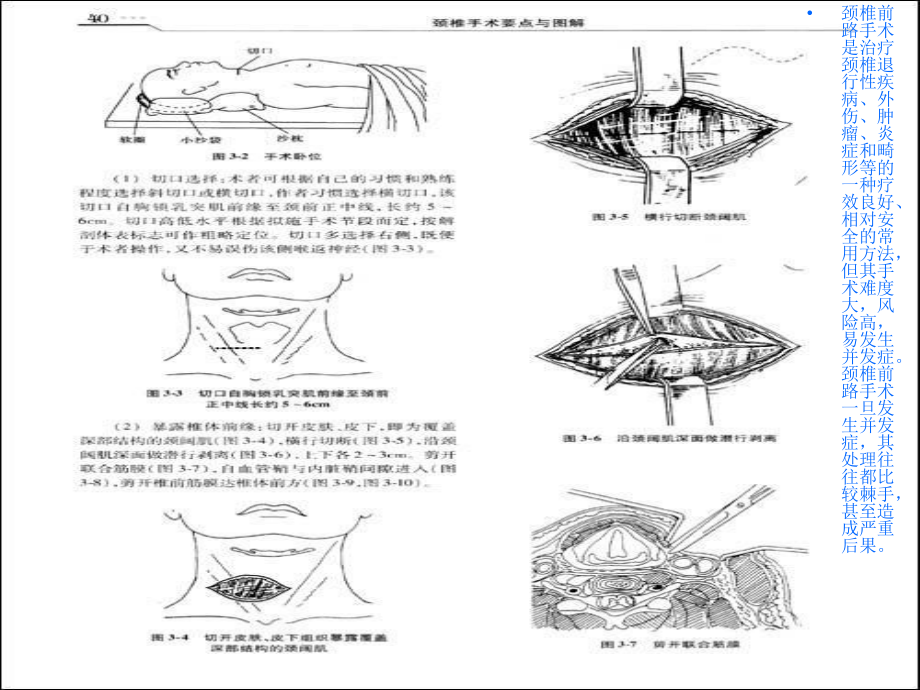 医学课件颈椎前路术后并发症及护理措施.ppt_第1页