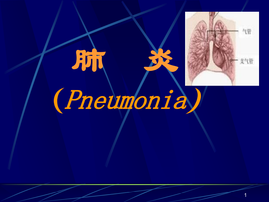 肺炎教学课件.ppt_第1页