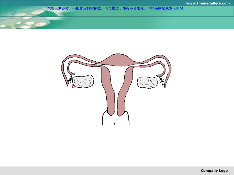 异位妊娠专题宣讲课件.ppt_第2页