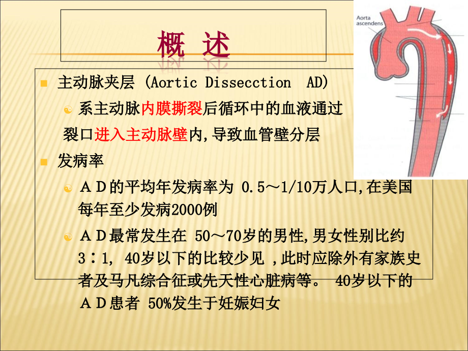 主动脉夹层课件PPT.ppt_第2页