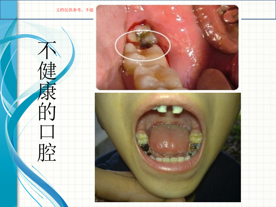 中学生口腔健康知识课件.ppt_第2页