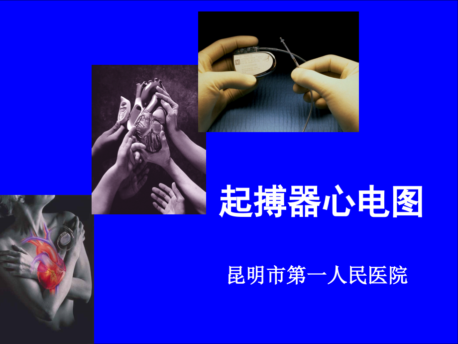 起搏器心电图-.ppt_第1页