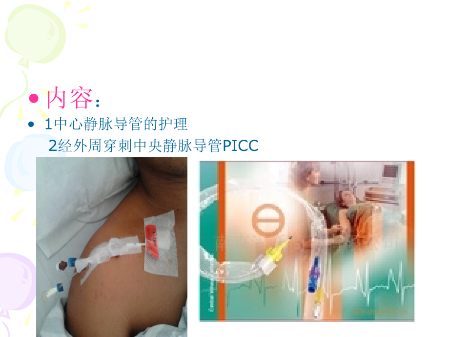 静脉导管的护理-.ppt_第2页