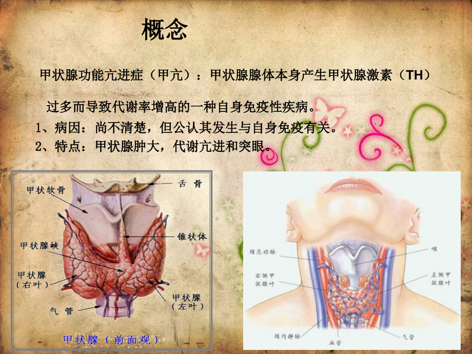 医学课件甲状腺功能亢进患者护理查房.ppt_第2页