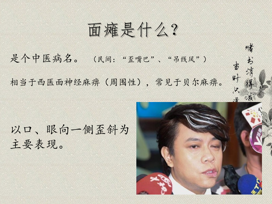 医学面神经炎面瘫的针灸康复治疗思路.ppt_第2页