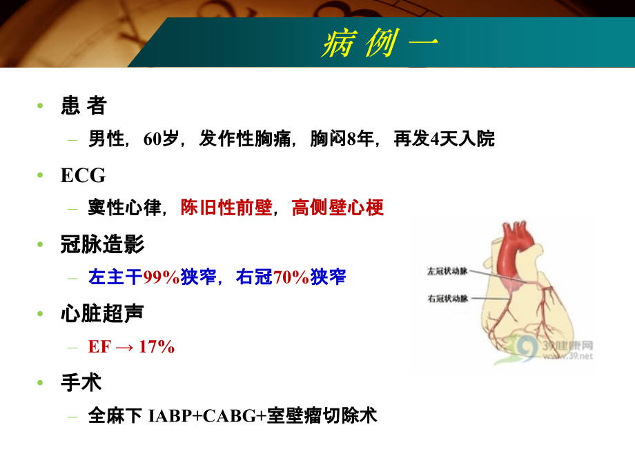高龄髋部骨折患者手术麻醉.ppt_第2页