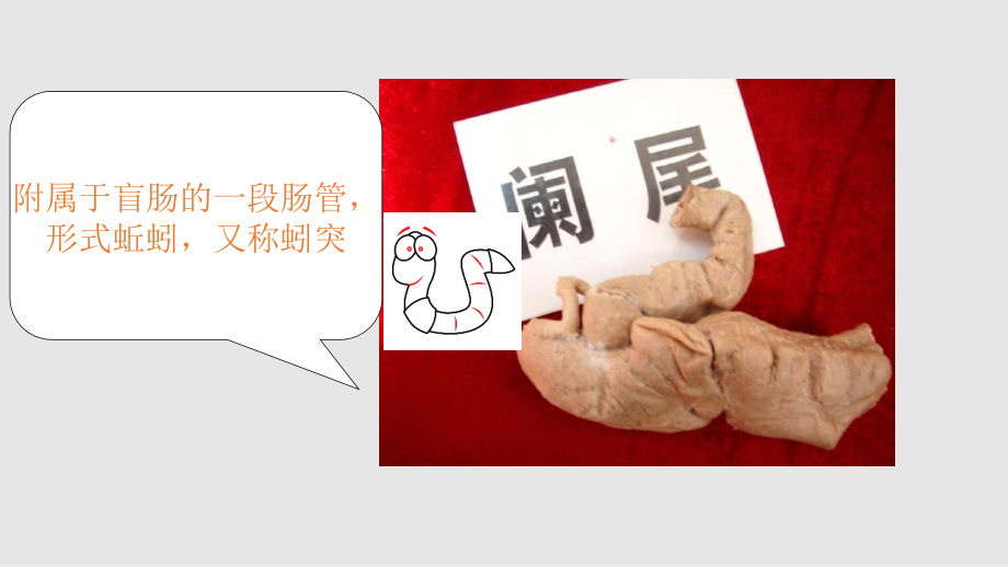 阑尾炎影像学资料.ppt_第2页