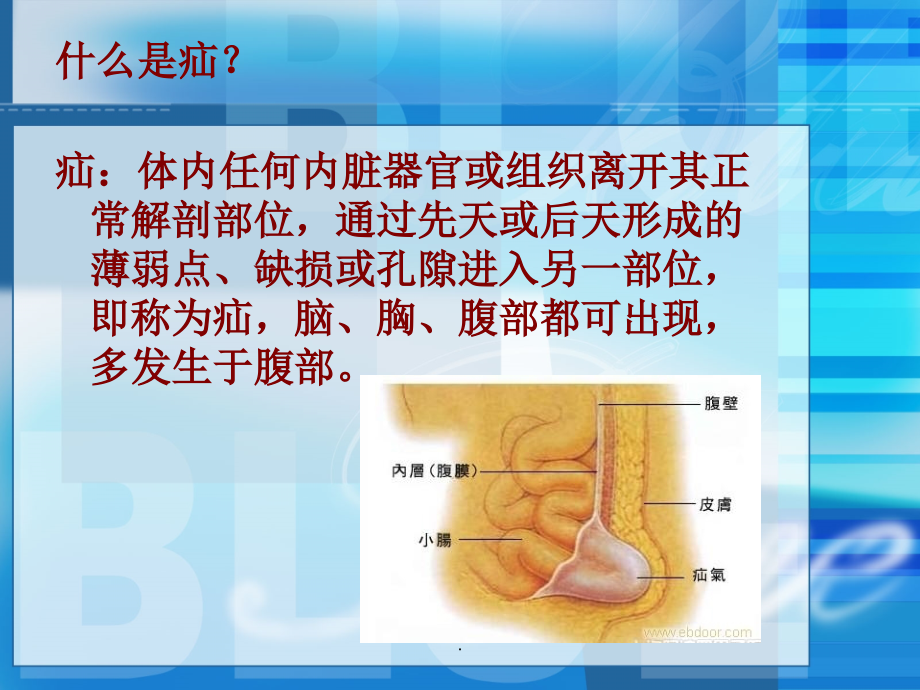 无张力疝术前术后护理.ppt_第2页