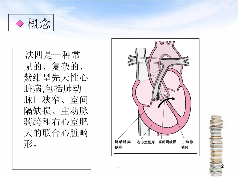 法洛四联症超声诊断要点课件.ppt_第2页