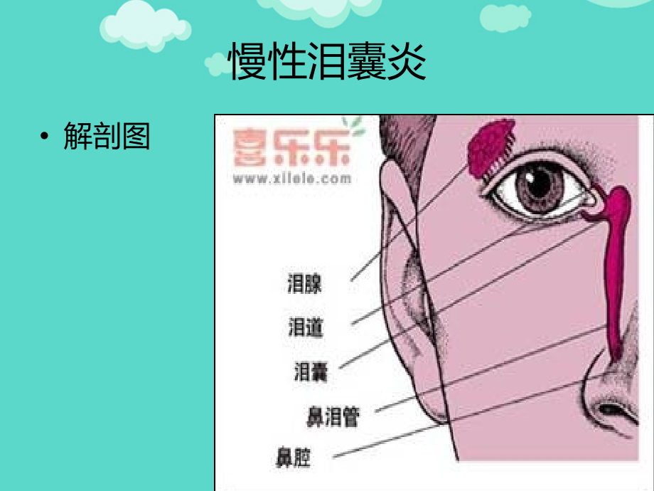 慢性泪囊炎护理查房文档.ppt_第2页