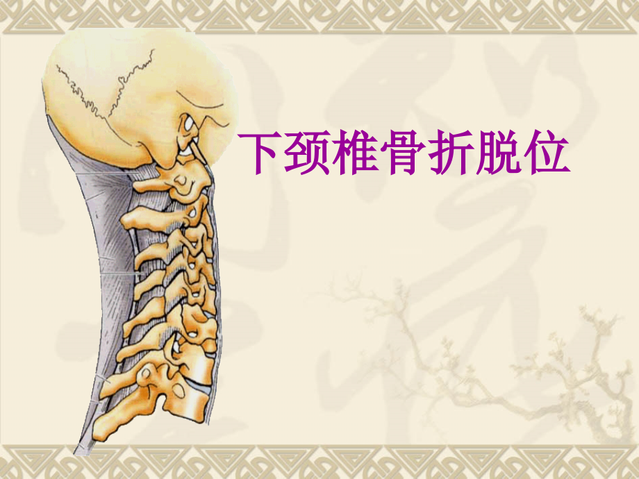 颈椎骨折脱位诊断与治疗.ppt_第1页