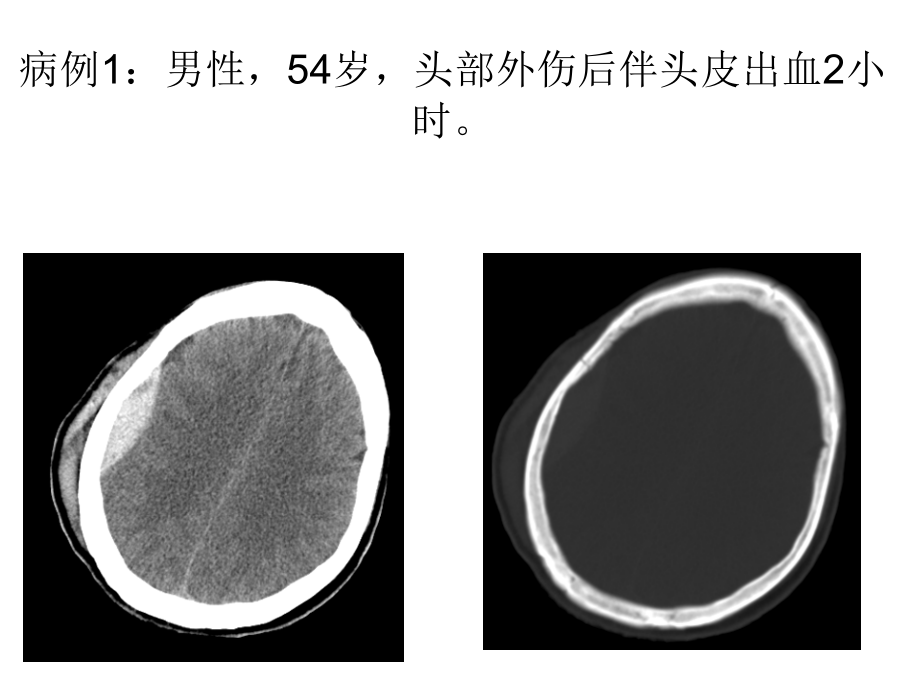 头颈部外伤病例常见病多发病.pptx_第2页
